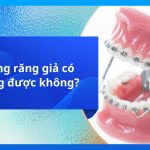 Trồng răng giả có niềng được không?