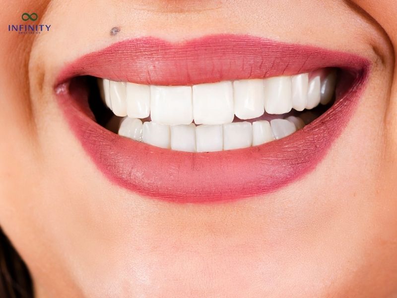 Trường hợp nên bọc răng sứ và không nên bọc răng sứ Trường hợp nên bọc răng sứ và không nên bọc răng sứ