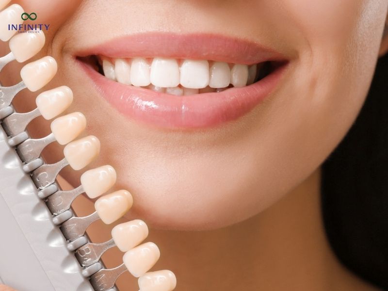 Các phương pháp phục hình răng sứ phổ biến và hình ảnh phục hình răng sứ Các phương pháp phục hình răng sứ phổ biến và hình ảnh phục hình răng sứ
