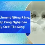 Gắn Attachment Niềng Răng: Giải Pháp Công Nghệ Cao Cho Nụ Cười Tỏa Sáng