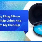 Niềng Răng Silicon - Giải Pháp Chỉnh Nha Thẩm Mỹ Hiện Đại