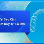 Tại Sao Cần Đeo Hàm Duy Trì Cả Đời