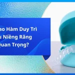 Tại Sao Hàm Duy Trì Sau Niềng Răng Quan Trọng?