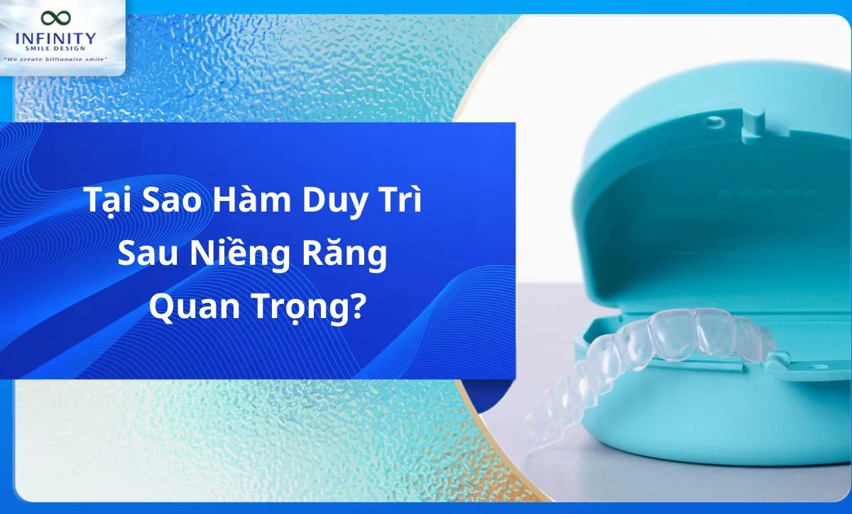 Tại Sao Hàm Duy Trì Sau Niềng Răng Quan Trọng?