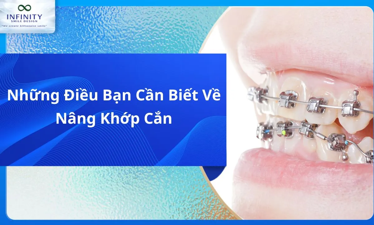 Những Điều Bạn Cần Biết Về Nâng Khớp Cắn