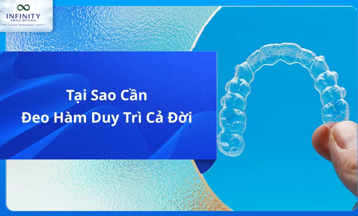Tại Sao Cần Đeo Hàm Duy Trì Cả Đời