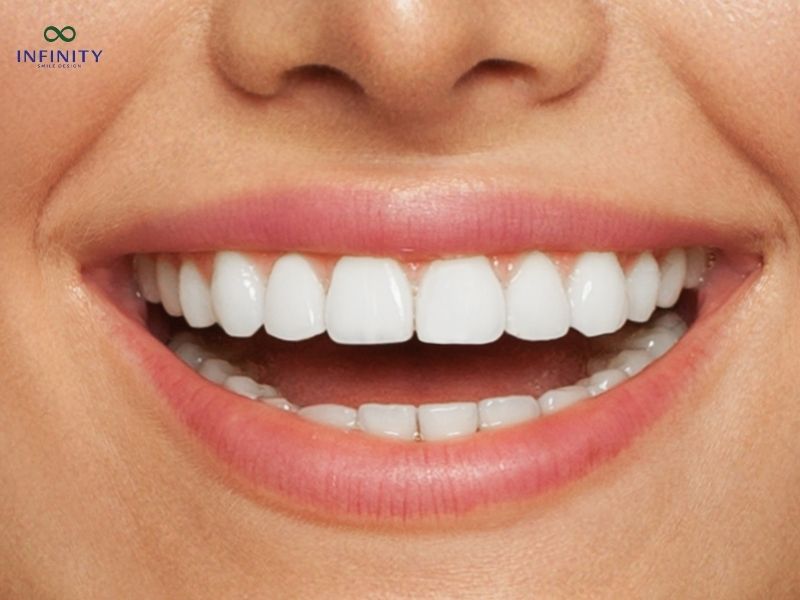 Trường hợp không nên bọc răng sứ Trường hợp không nên bọc răng sứ