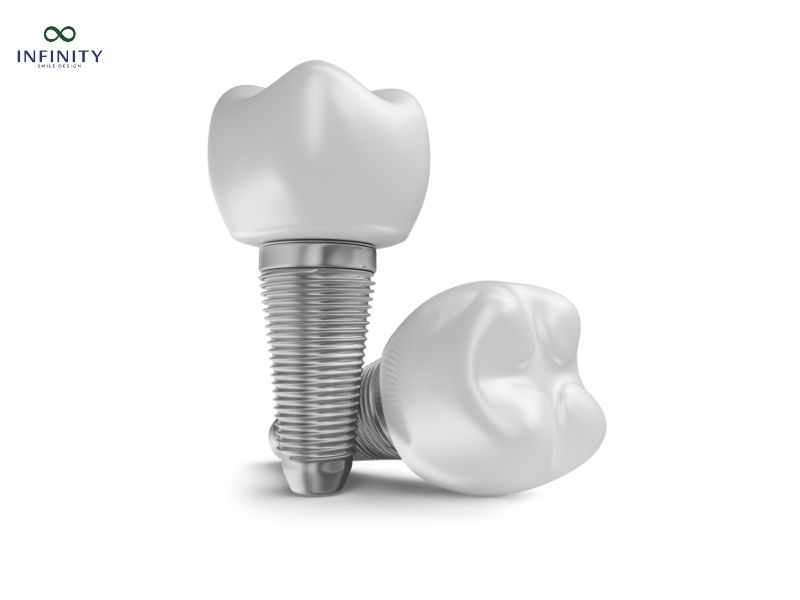 Có mấy cách phục hình răng sứ trên Implant?