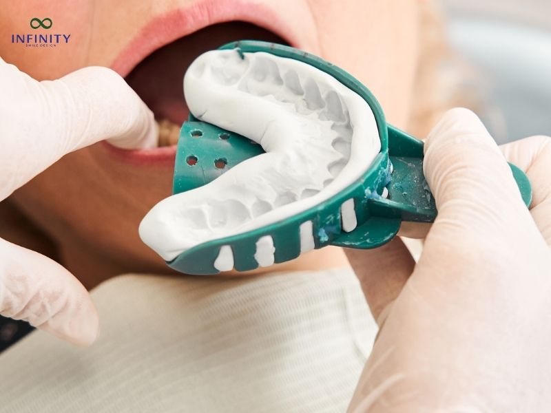 Lấy dấu răng có đau không?