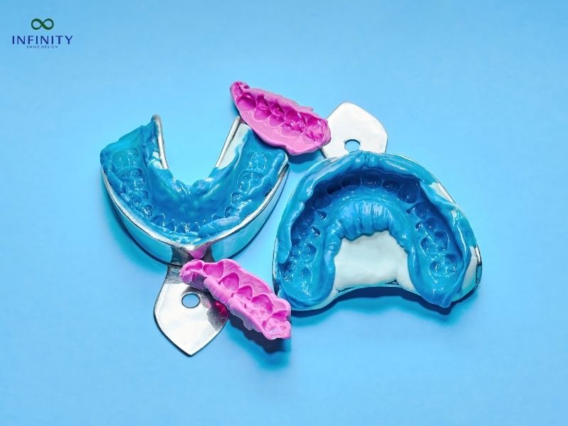 Lấy dấu răng bao nhiêu tiền?