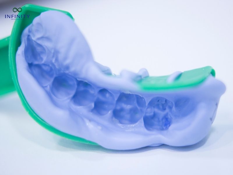 Lợi ích của việc lựa chọn phương pháp lấy dấu răng hiện đại