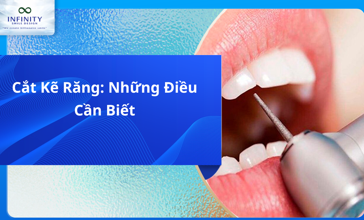Cắt Kẽ Răng: Những Điều Cần Biết
