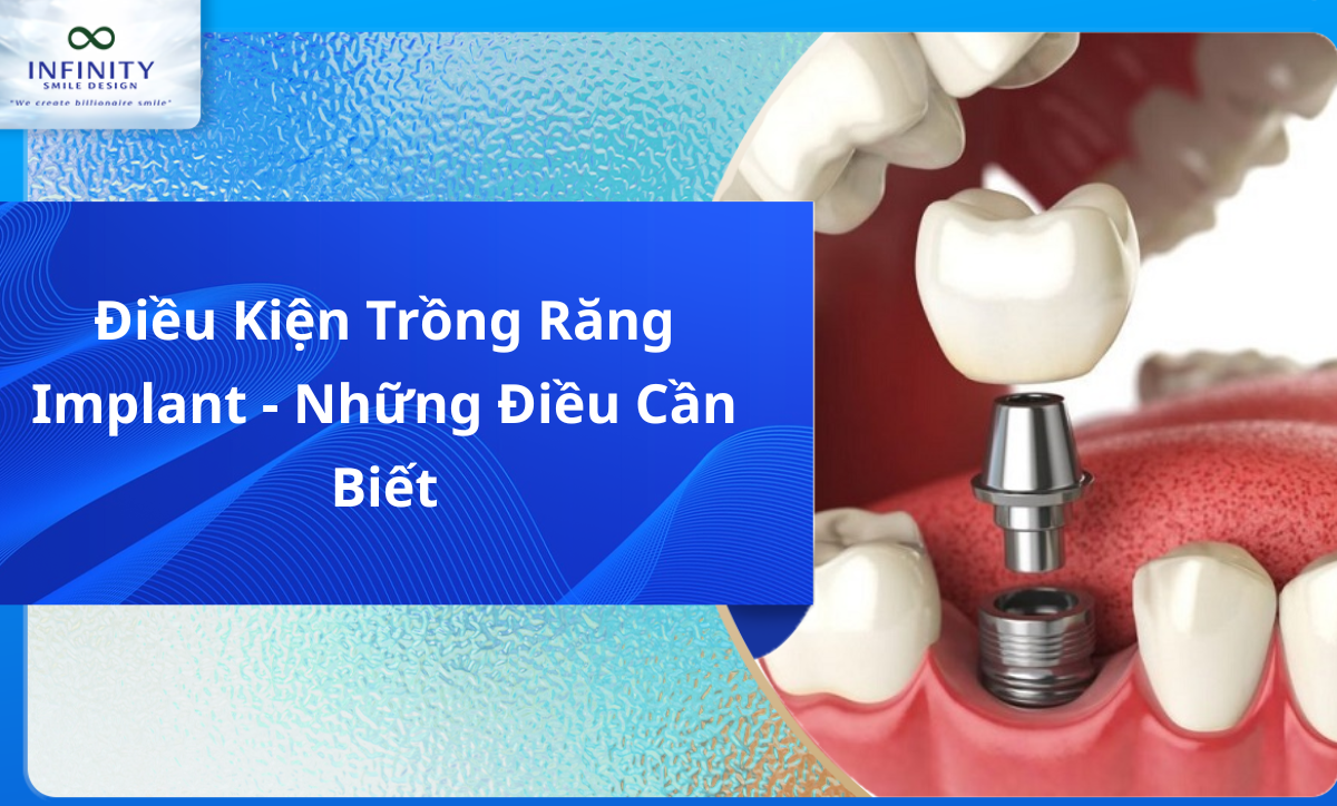 Điều kiện trồng răng implant