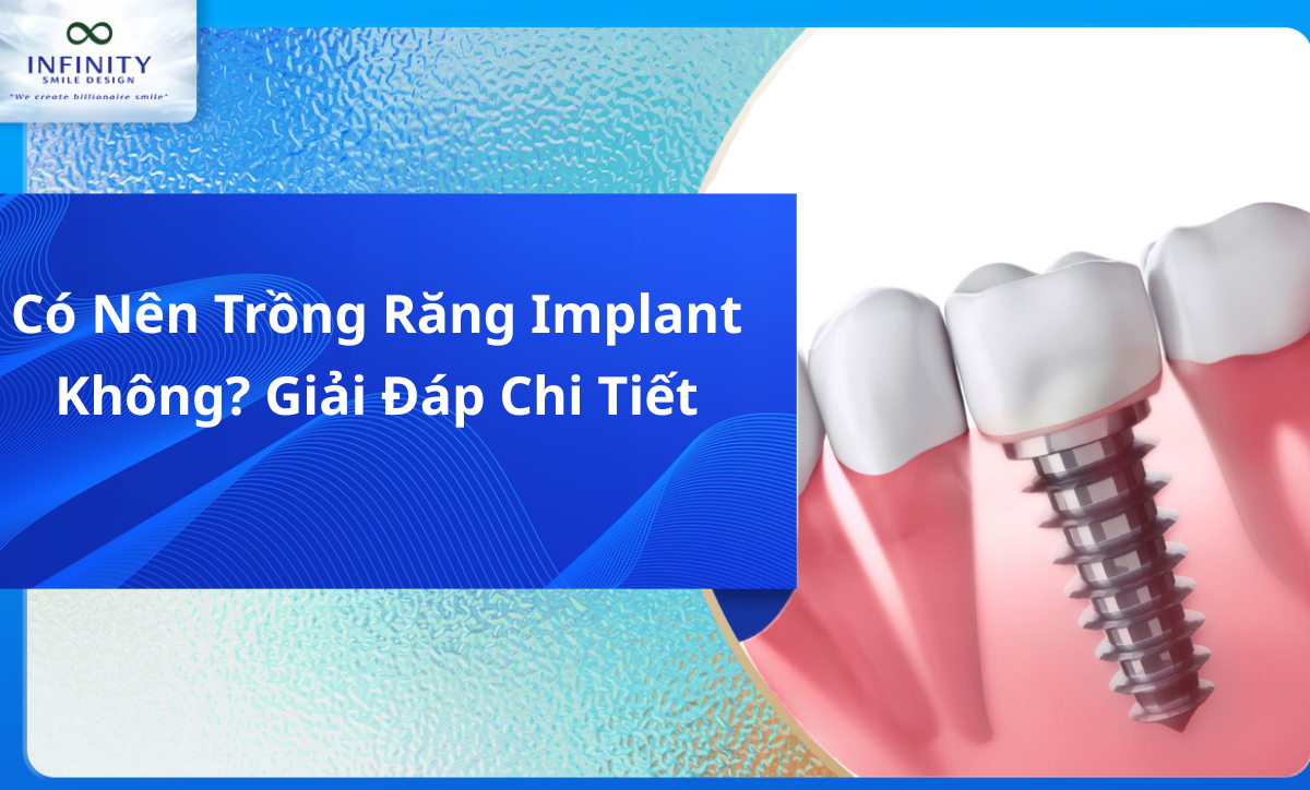 Có Nên Trồng Răng Implant Không? Giải Đáp Chi Tiết