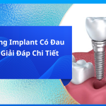 Trồng răng Implant có đau không?