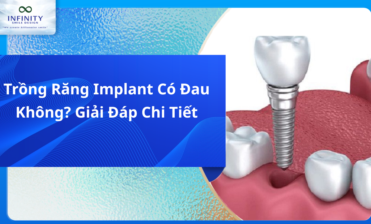 Trồng răng Implant có đau không?