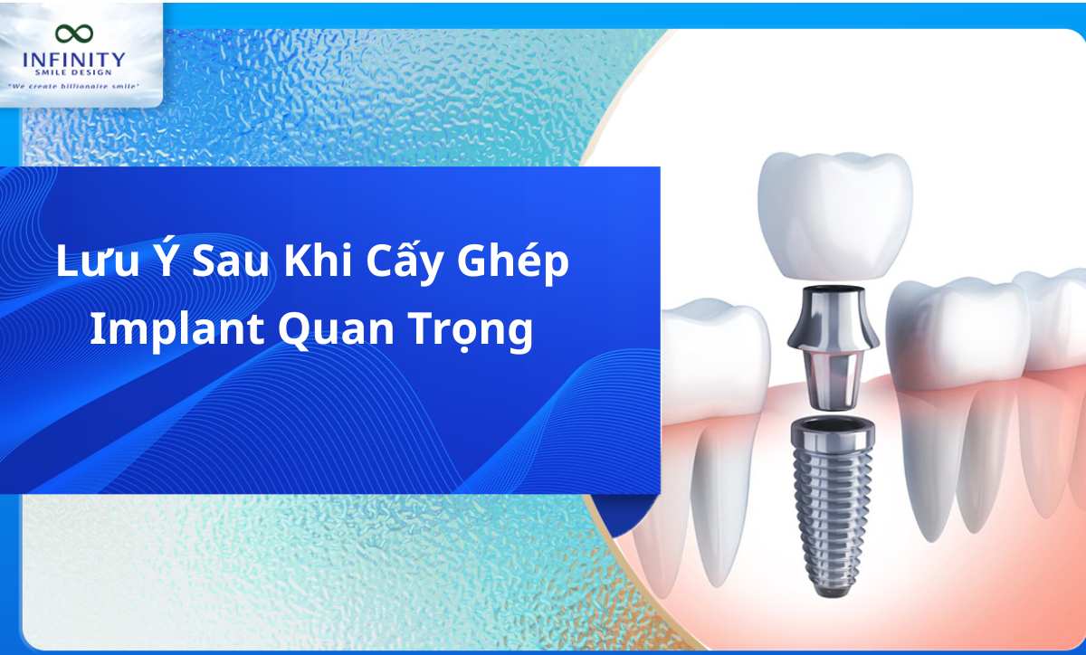 Lưu ý sau khi cấy ghép Implant