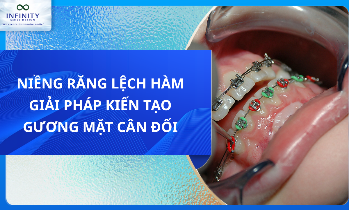 NIỀNG RĂNG LỆCH HÀM GIẢI PHÁP KIẾN TẠO GƯƠNG MẶT CÂN ĐỐI