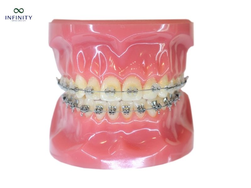 Những trường hợp đặc biệt và giải pháp thay thế