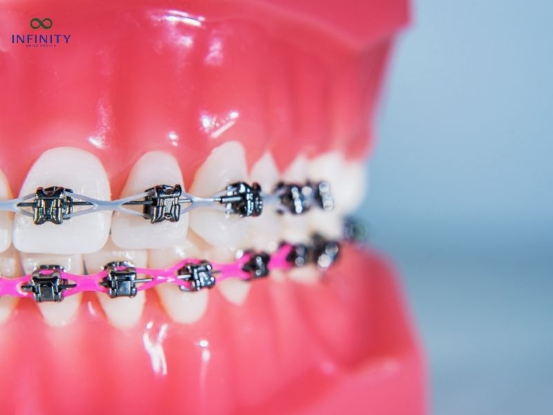 Những trường hợp đặc biệt và giải pháp thay thế
