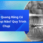 Chụp X Quang Răng Có Những Loại Nào? Quy Trình Chụp