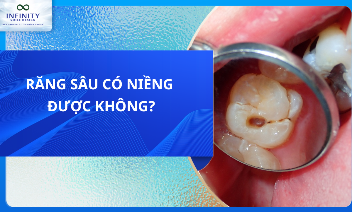 Răng sâu có niềng được không?