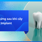 Biến chứng sau khi cấy implant
