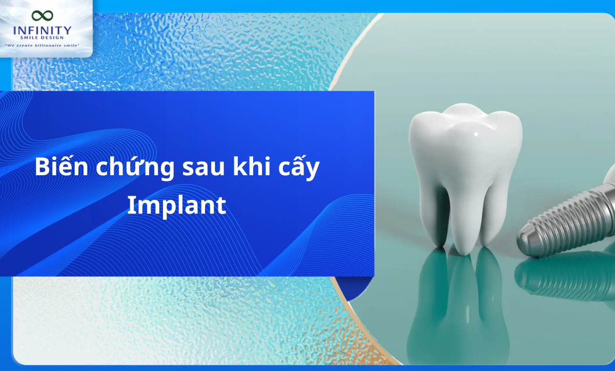 Biến chứng sau khi cấy implant