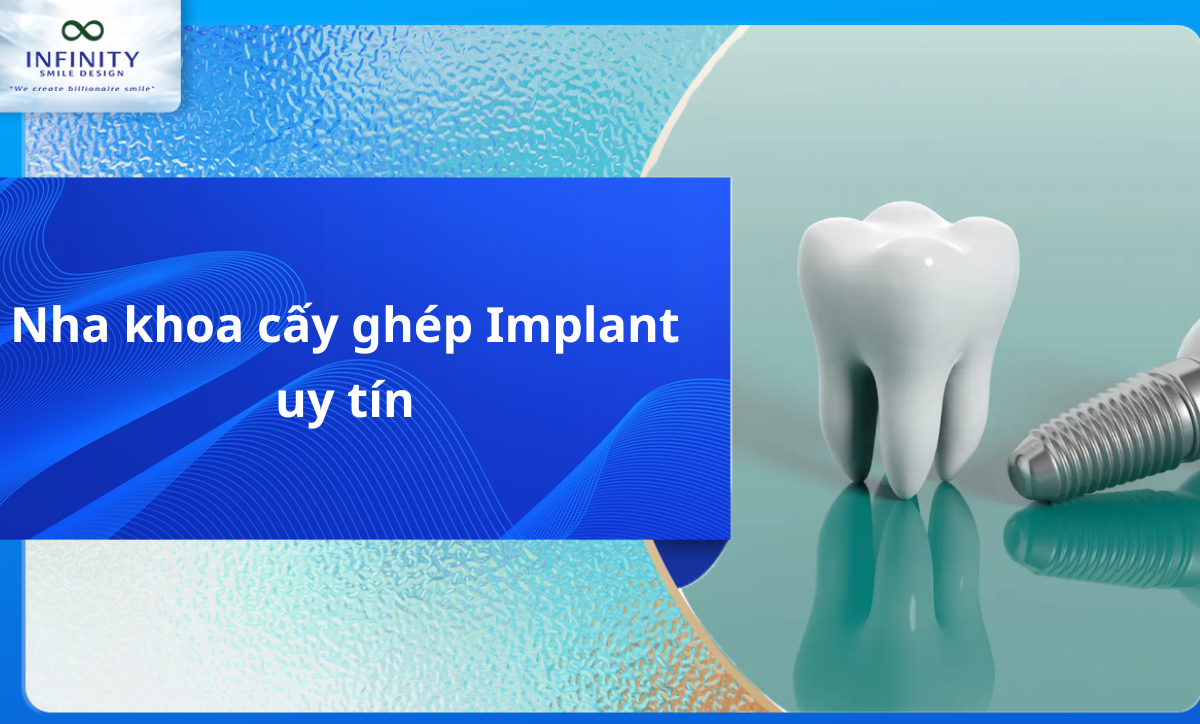 Nha khoa cấy ghép implant uy tín