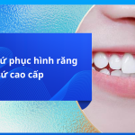 5 dòng sứ phục hình răng sứ cao cấp