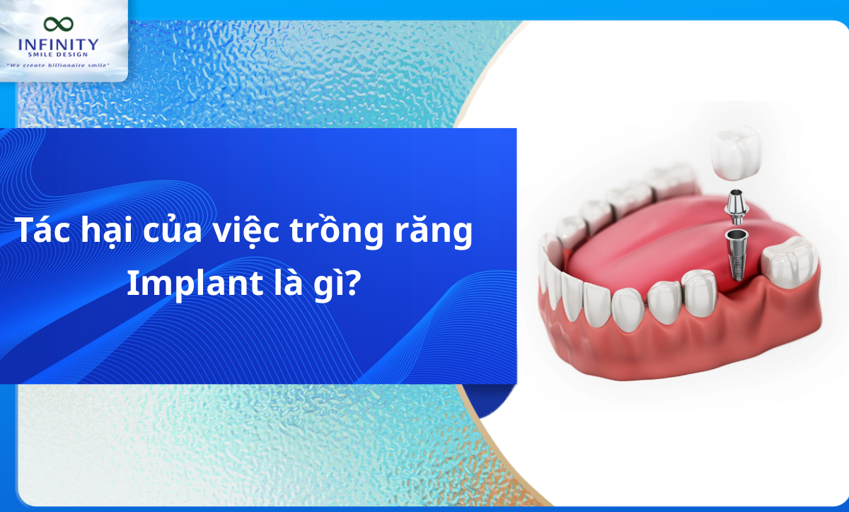 Tác hại của việc trồng răng Implant là gì?