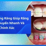 Lò Xo Niềng Răng Giúp Răng Dịch Chuyển Nhanh Và Chính Xác