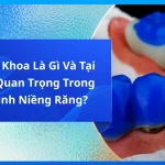 Sáp Nha Khoa Là Gì Và Tại Sao Nó Quan Trọng Trong Quá Trình Niềng Răng?