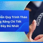 Hướng Dẫn Quy Trình Tháo Niềng Răng Chi Tiết Và Đầy Đủ Nhất