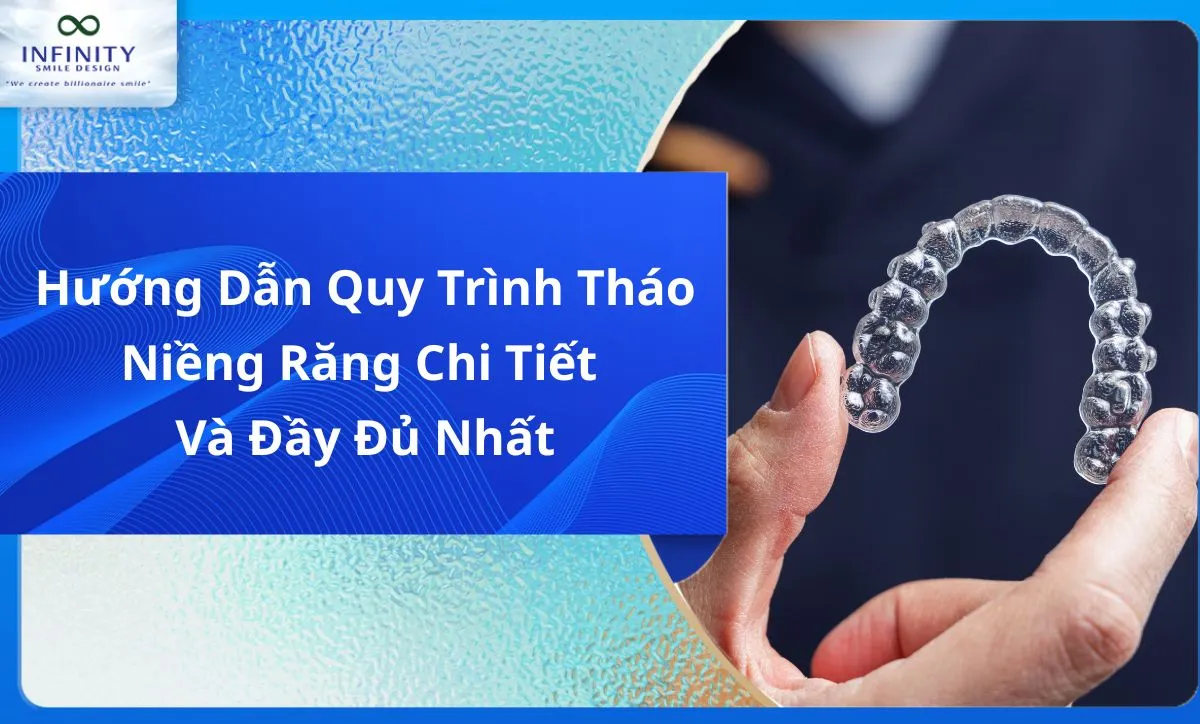 Hướng Dẫn Quy Trình Tháo Niềng Răng Chi Tiết Và Đầy Đủ Nhất