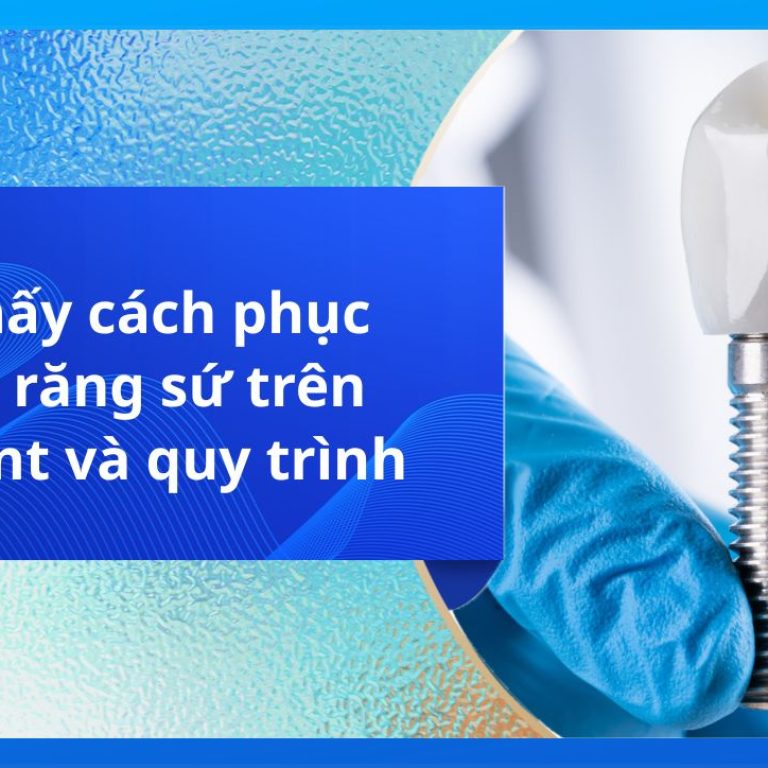 Có mấy cách phục hình răng sứ trên implant và quy trình