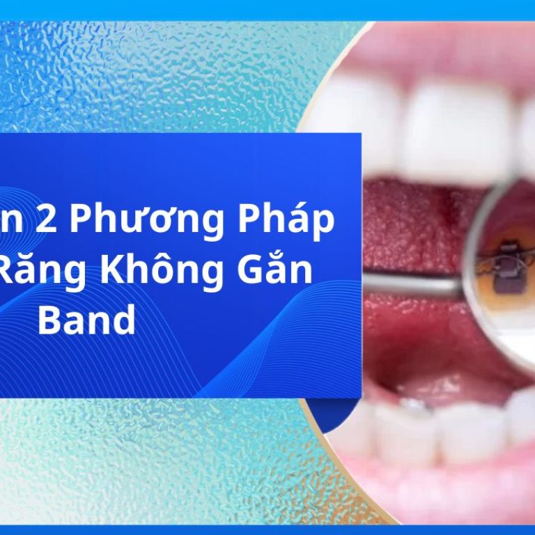 Lựa Chọn 2 Phương Pháp Niềng Răng Không Gắn Band