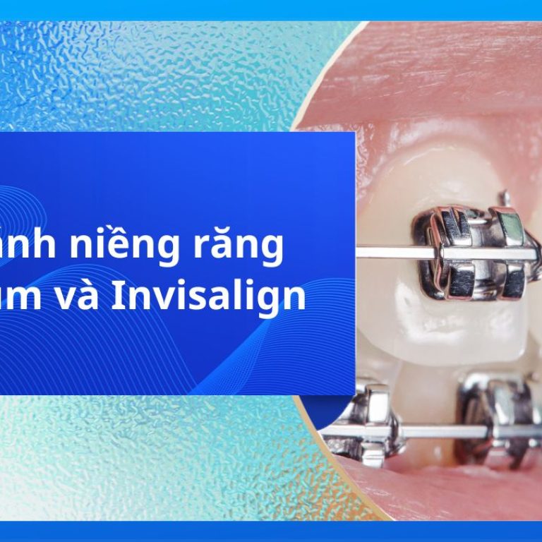 So sánh niềng răng Zenyum và Invisalign