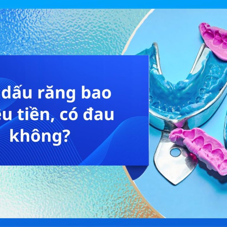 Lấy dấu răng bao nhiêu tiền, có đau không?
