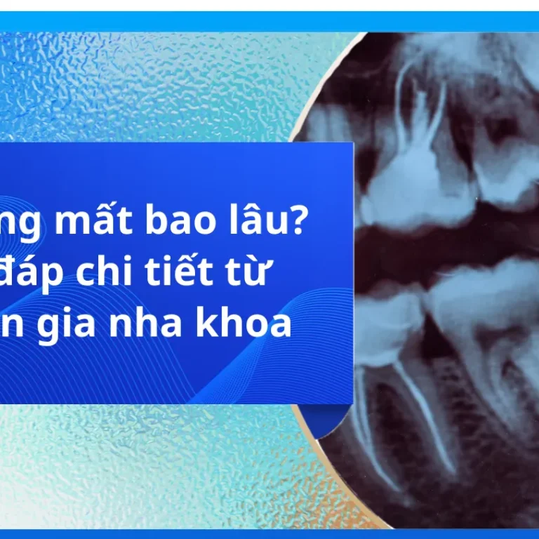 Kéo răng mất bao lâu? Giải đáp chi tiết từ chuyên gia nha khoa