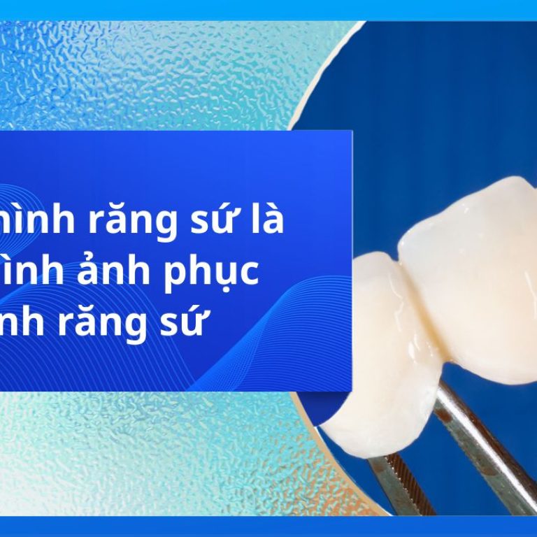 Phục hình răng sứ là gì? Hình ảnh phục hình răng sứ