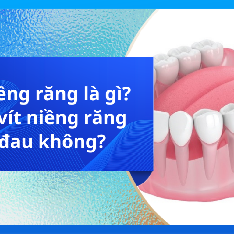 Vít niềng răng là gì? Cắm vít niềng răng có đau không?