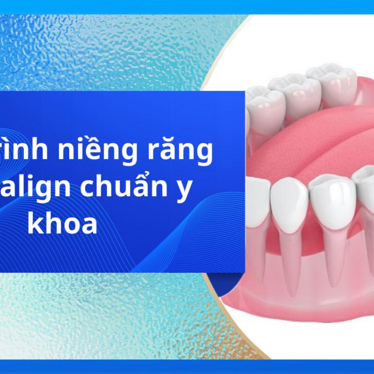 Quy trình niềng răng invisalign chuẩn y khoa