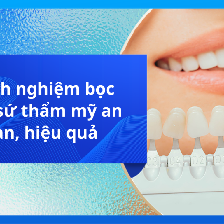 8 kinh nghiệm bọc răng sứ thẩm mỹ an toàn, hiệu quả