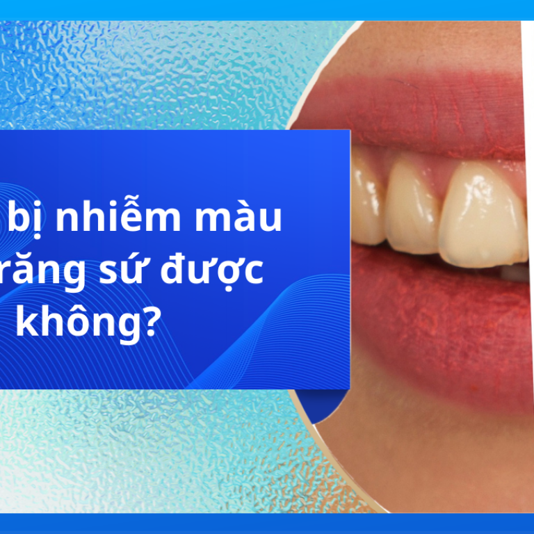 Răng bị nhiễm màu bọc răng sứ được không?