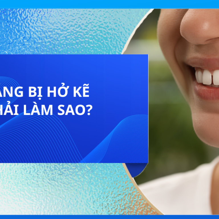 RĂNG BỊ HỞ KẼ PHẢI LÀM SAO?
