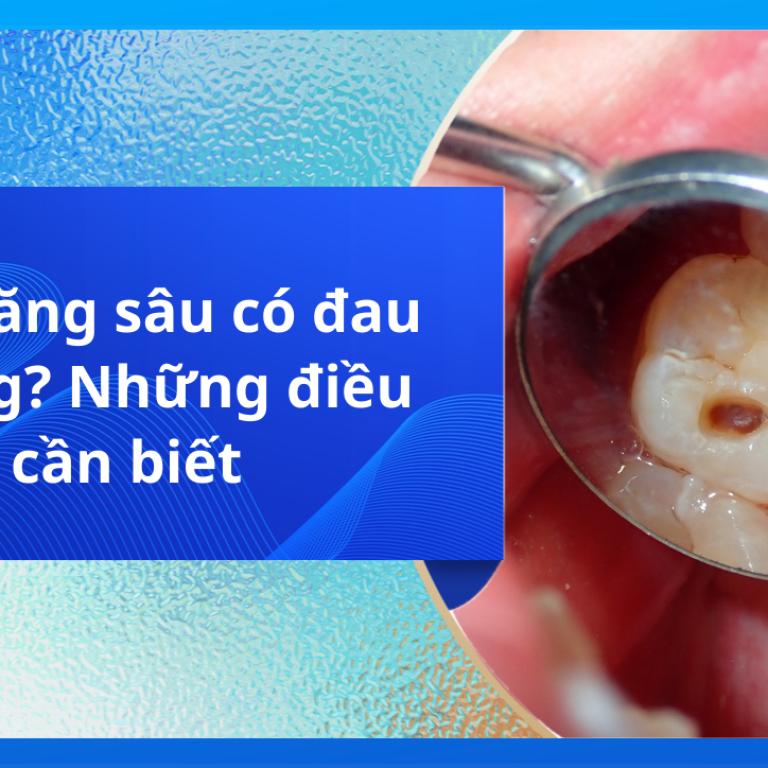 Hàn răng sâu có đau không? Những điều cần biết