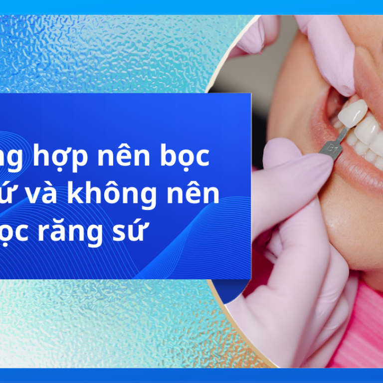 Trường hợp nên bọc răng sứ và không nên bọc răng sứ