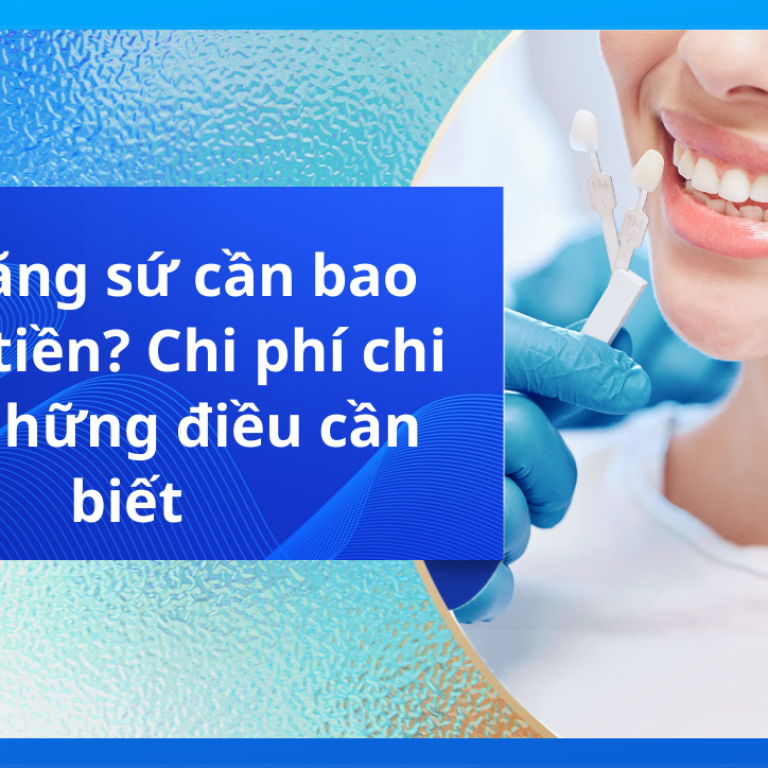 Bọc răng sứ cần bao nhiêu tiền? Chi phí chi tiết, những điều cần biết