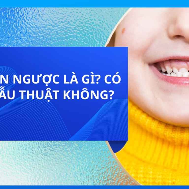 KHỚP CẮN NGƯỢC LÀ GÌ? CÓ CẦN PHẪU THUẬT KHÔNG?